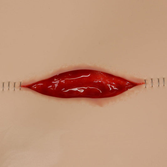 Dehisced Wound Board, light