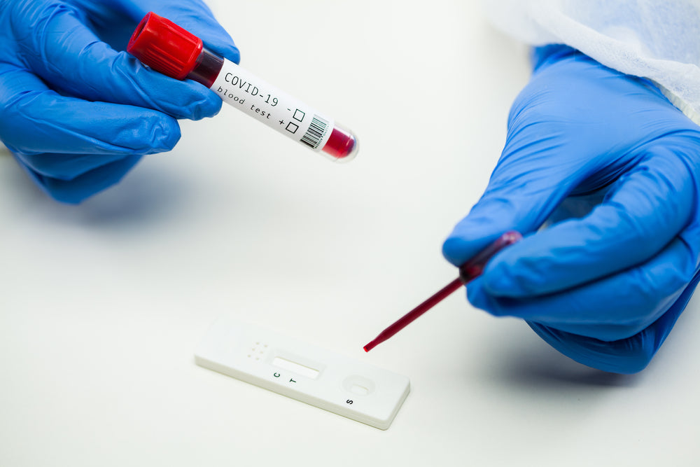 Gloved hands using blood sample and pipette for rapid COVID-19 test on white surface