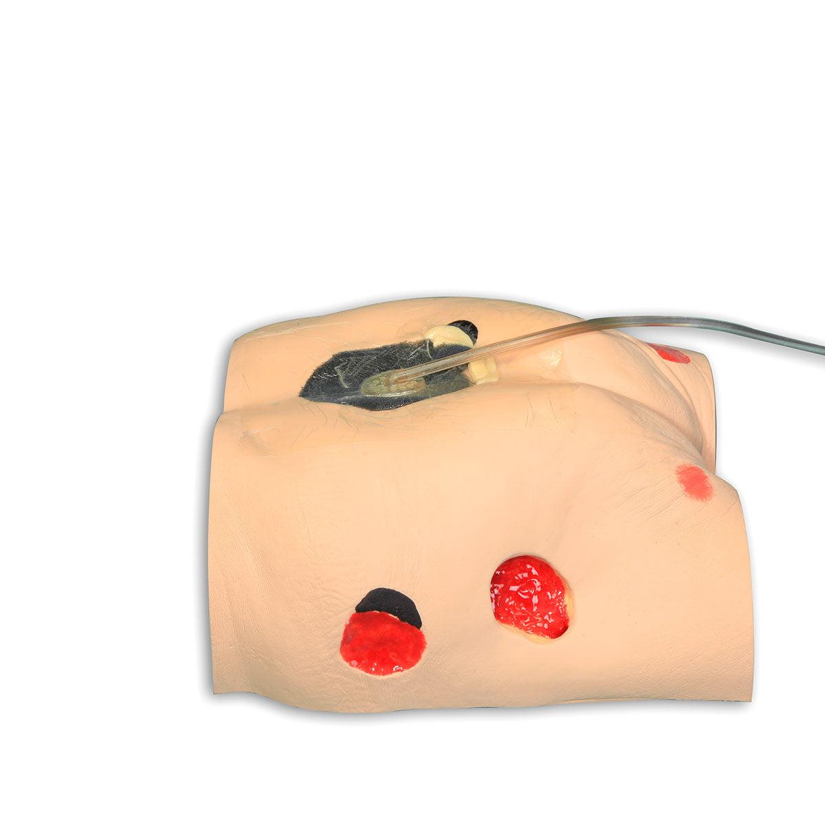 3B Scientific Seymour II™ Wound Care Simulator showing realistic wound models for medical training and practice.